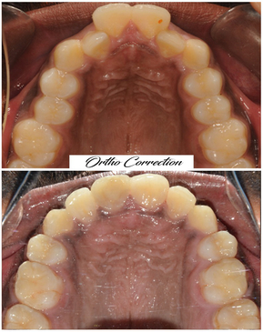 Slider image (3) FMS International Dental Center